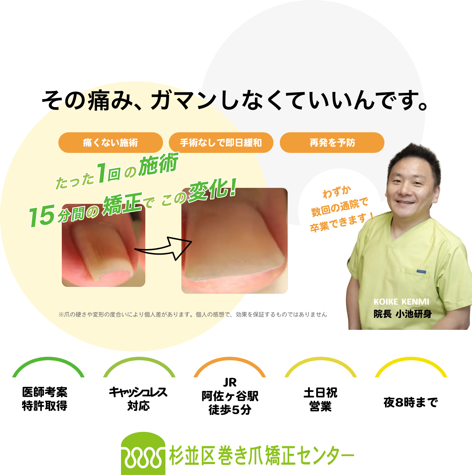 杉並区巻き爪矯正センター｜巻き爪・陥入爪・肥厚爪｜ツメフラ法
